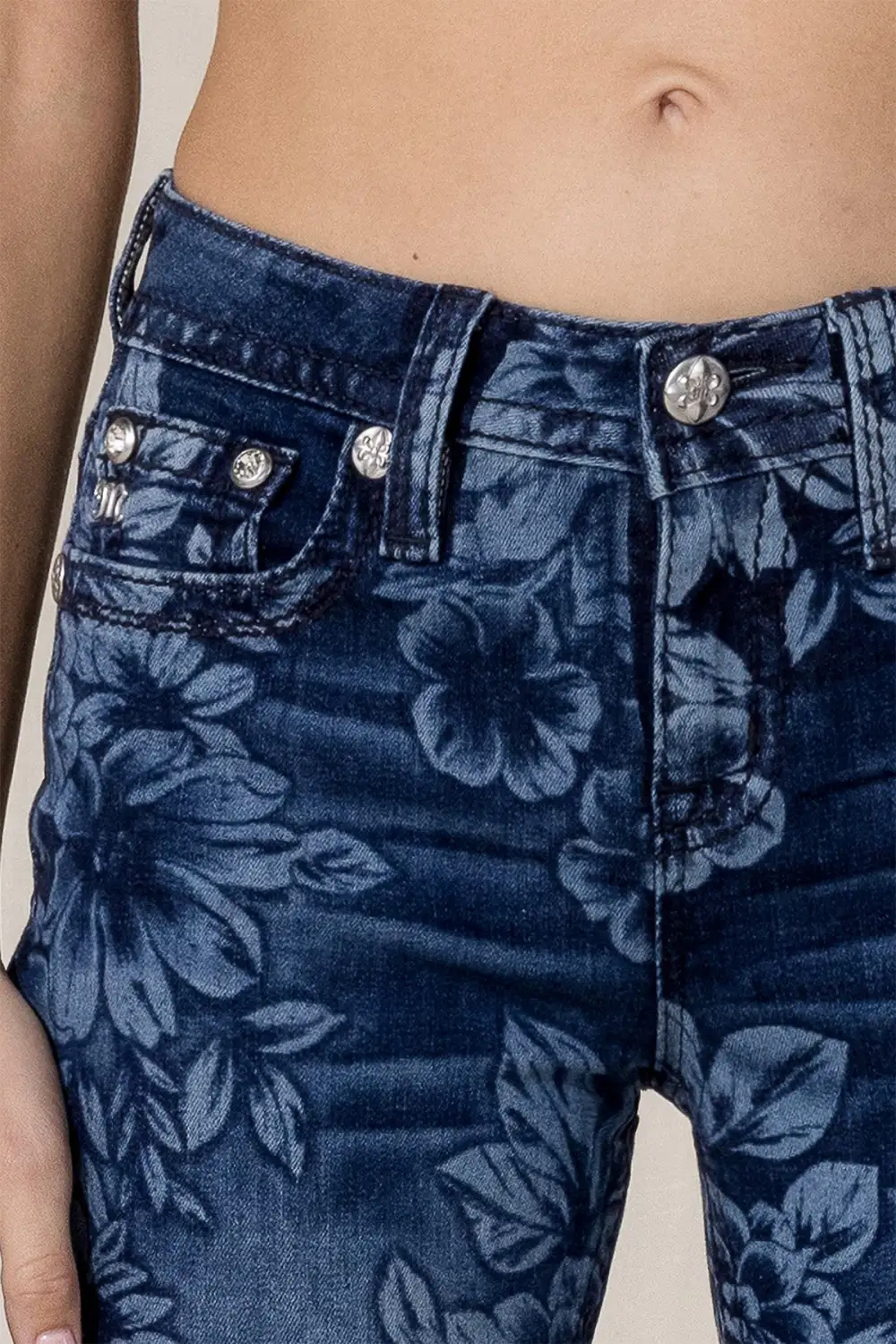 Super Bloom Skinny Jeans
